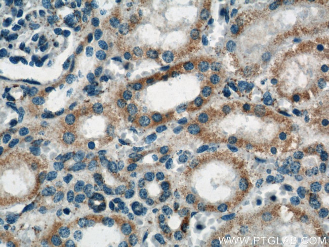 ACTO9 Antibody in Immunohistochemistry (Paraffin) (IHC (P))