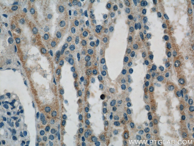 ACTO9 Antibody in Immunohistochemistry (Paraffin) (IHC (P))