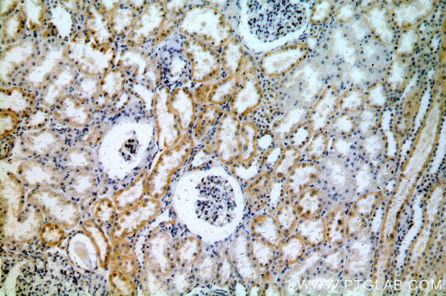 ACTO9 Antibody in Immunohistochemistry (Paraffin) (IHC (P))