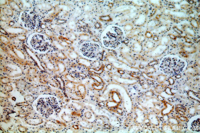 ACTO9 Antibody in Immunohistochemistry (Paraffin) (IHC (P))