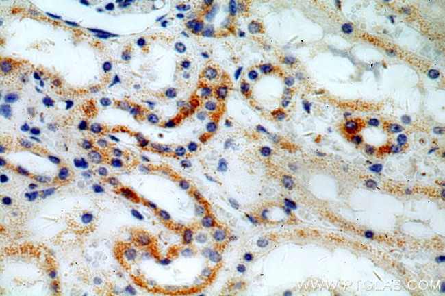 ACTO9 Antibody in Immunohistochemistry (Paraffin) (IHC (P))