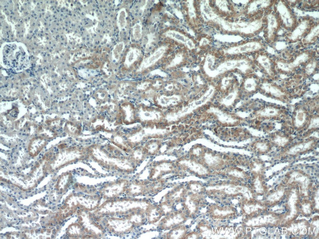 ACTO9 Antibody in Immunohistochemistry (Paraffin) (IHC (P))