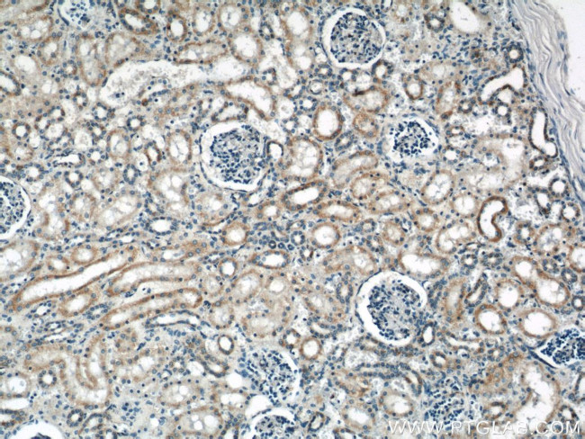 ACTO9 Antibody in Immunohistochemistry (Paraffin) (IHC (P))