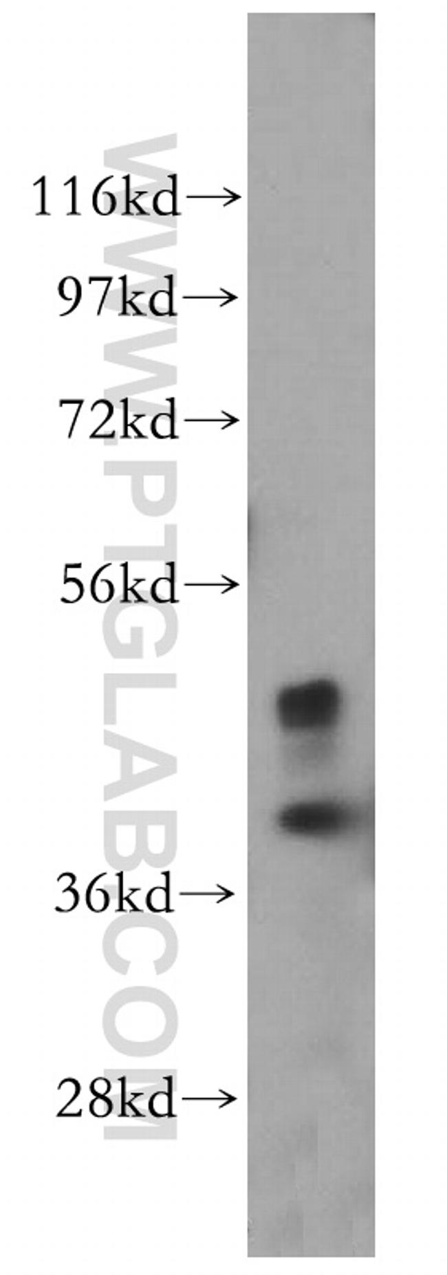 ACTO9 Antibody in Western Blot (WB)