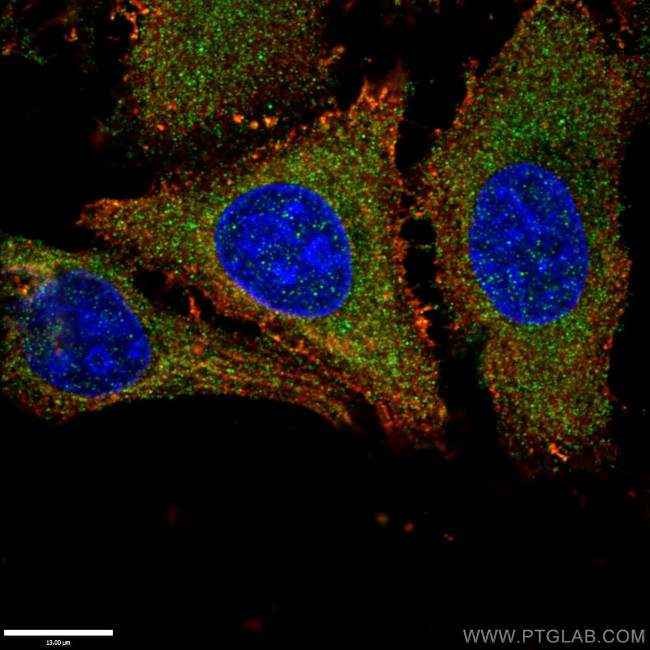 RAB11A/B Antibody in Immunocytochemistry (ICC/IF)