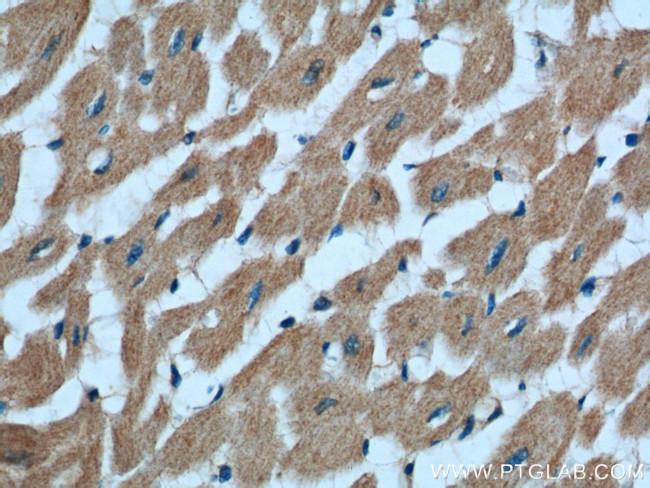 RAB11A/B Antibody in Immunohistochemistry (Paraffin) (IHC (P))