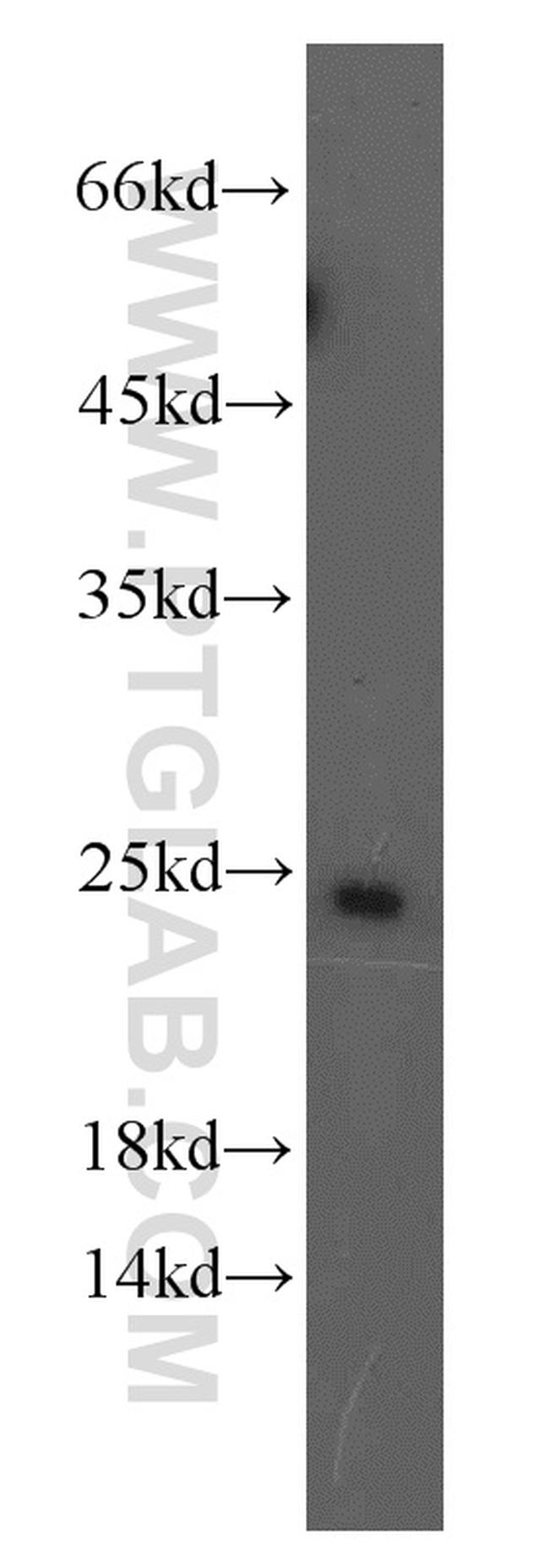 RAB11A/B Antibody in Western Blot (WB)