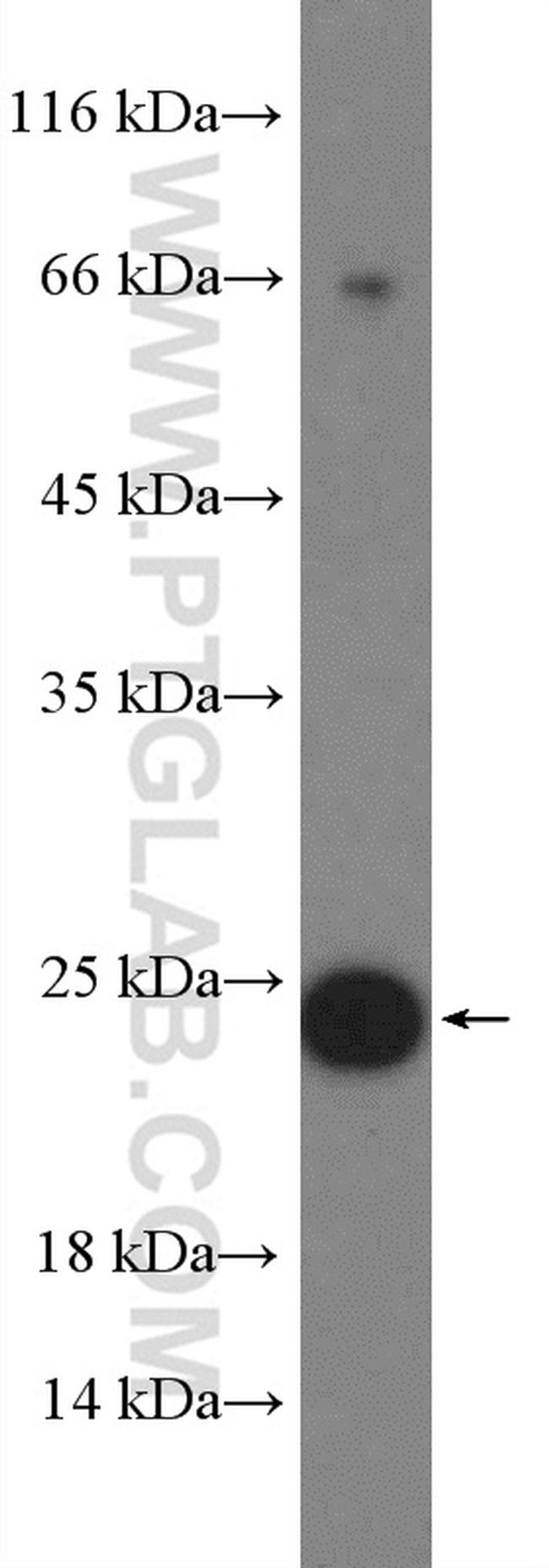 RAB11A/B Antibody in Western Blot (WB)