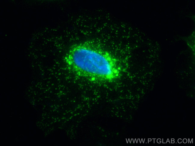 RAB11A/B Antibody in Immunocytochemistry (ICC/IF)