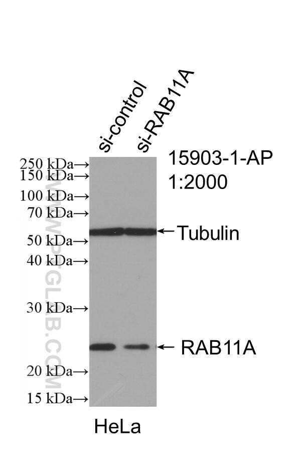 RAB11A/B Antibody in Western Blot (WB)