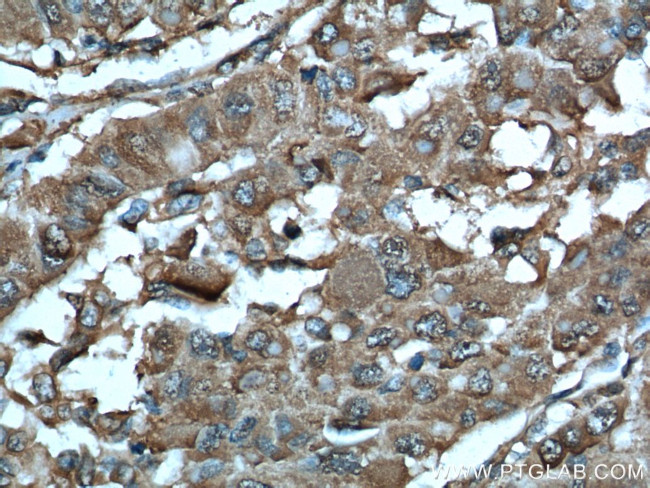 MDH1 Antibody in Immunohistochemistry (Paraffin) (IHC (P))