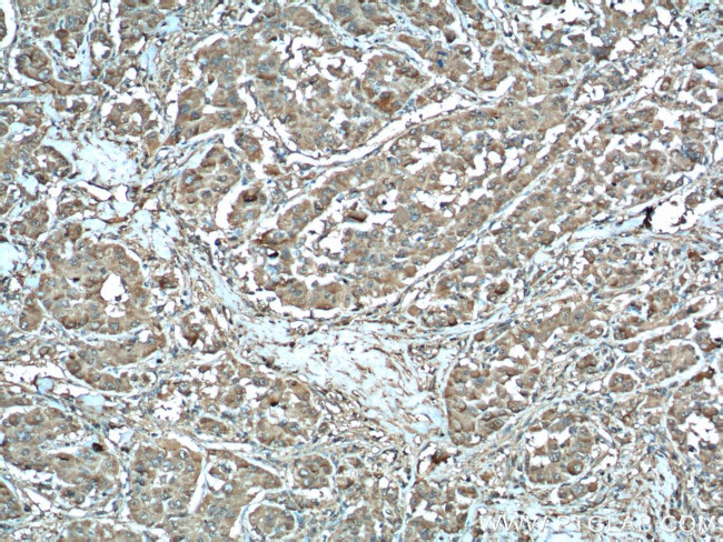 MDH1 Antibody in Immunohistochemistry (Paraffin) (IHC (P))