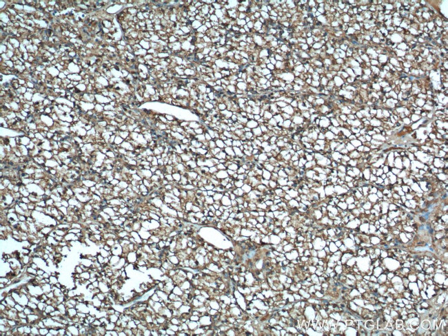 MDH1 Antibody in Immunohistochemistry (Paraffin) (IHC (P))