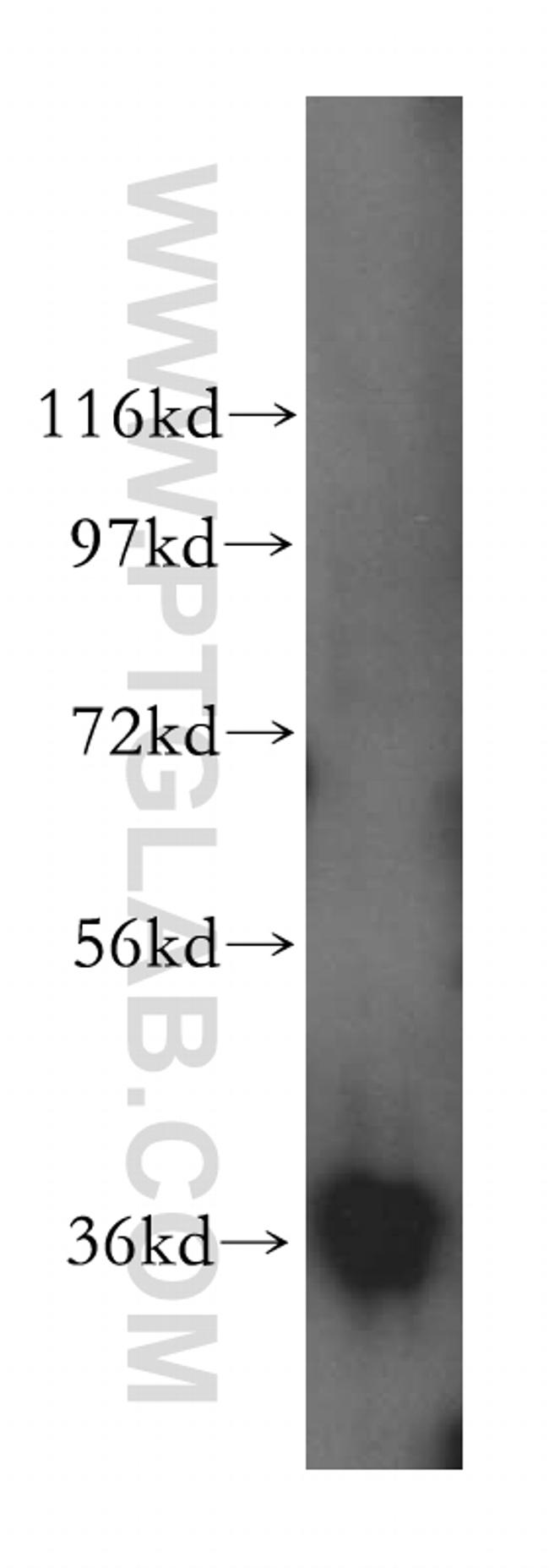 MDH1 Antibody in Western Blot (WB)