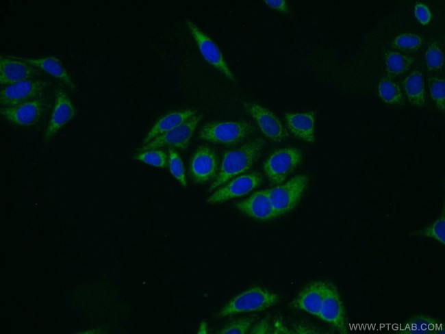 ALDH1A1 Antibody in Immunocytochemistry (ICC/IF)