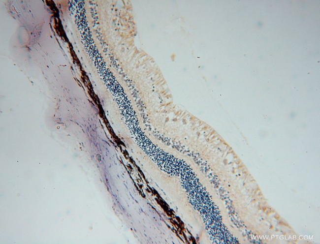 ALDH1A1 Antibody in Immunohistochemistry (Paraffin) (IHC (P))