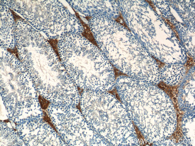 ALDH1A1 Antibody in Immunohistochemistry (Paraffin) (IHC (P))