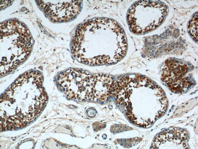 ALDH1A1 Antibody in Immunohistochemistry (Paraffin) (IHC (P))