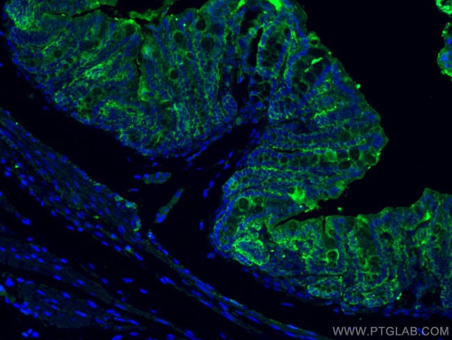 ALDH1A1 Antibody in Immunohistochemistry (PFA fixed) (IHC (PFA))