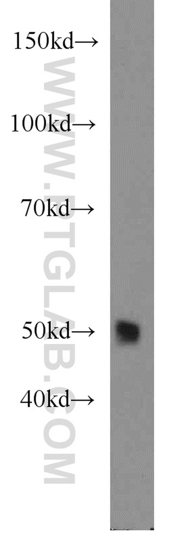 ALDH1A1 Antibody in Western Blot (WB)