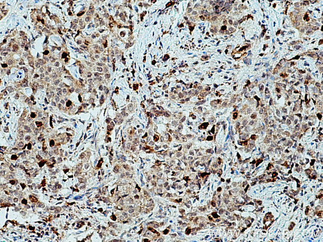 KIF20A Antibody in Immunohistochemistry (Paraffin) (IHC (P))