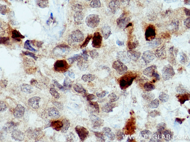 KIF20A Antibody in Immunohistochemistry (Paraffin) (IHC (P))