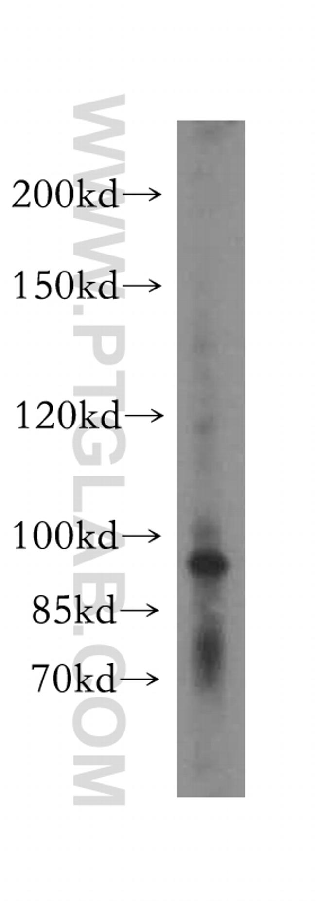 KIF20A Antibody in Western Blot (WB)