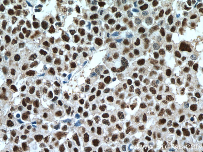 UBE1 Antibody in Immunohistochemistry (Paraffin) (IHC (P))