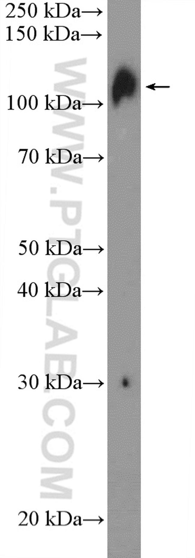 UBE1 Antibody in Western Blot (WB)