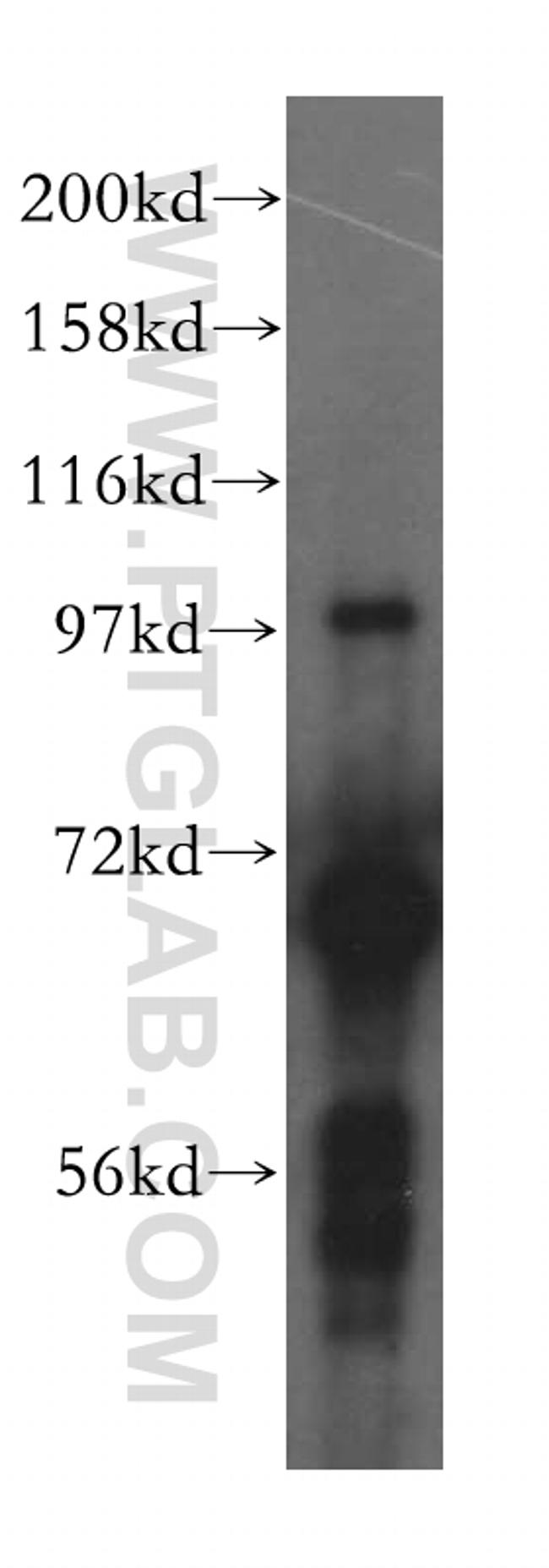 CTP synthase Antibody in Western Blot (WB)