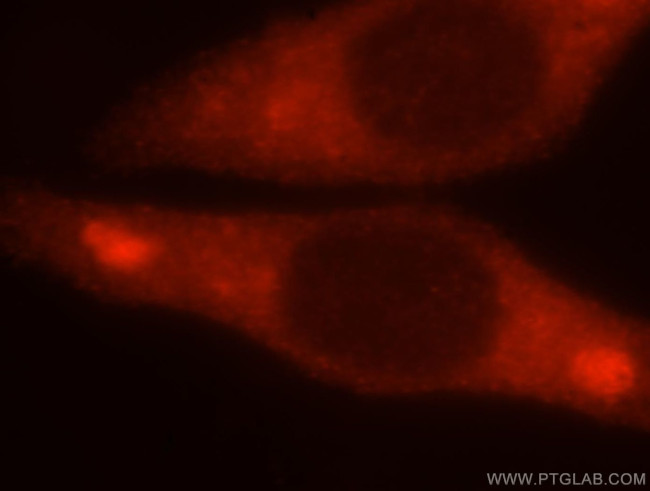 CTP synthase Antibody in Immunocytochemistry (ICC/IF)