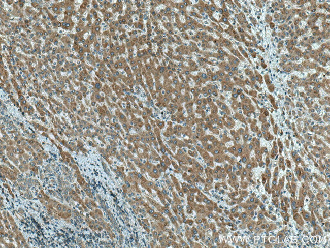 CTP synthase Antibody in Immunohistochemistry (Paraffin) (IHC (P))