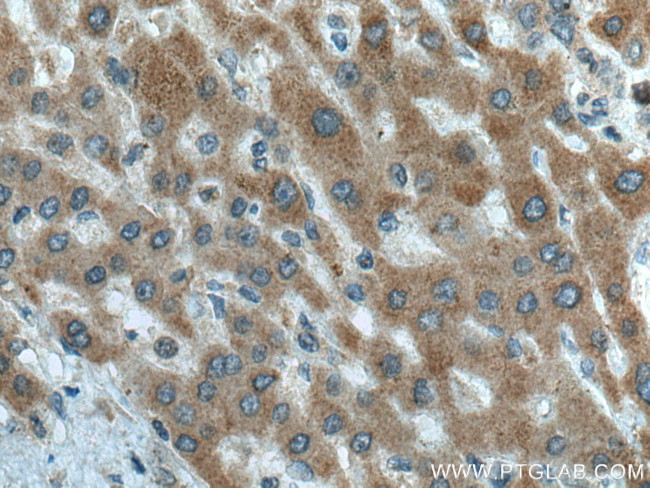 CTP synthase Antibody in Immunohistochemistry (Paraffin) (IHC (P))