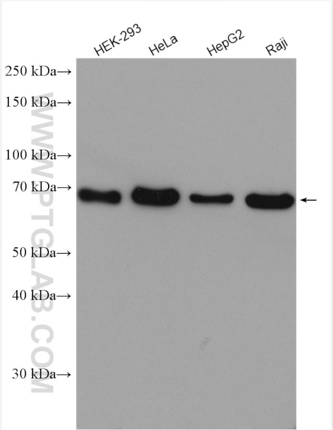 CTP synthase Antibody in Western Blot (WB)