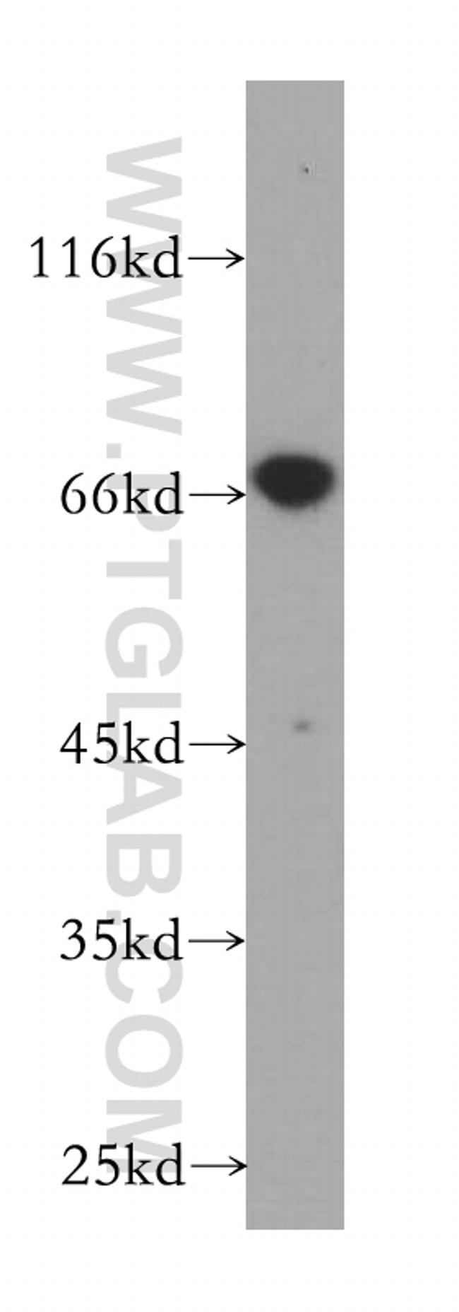 CTP synthase Antibody in Western Blot (WB)