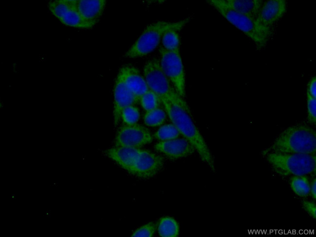 VPS26B Antibody in Immunocytochemistry (ICC/IF)