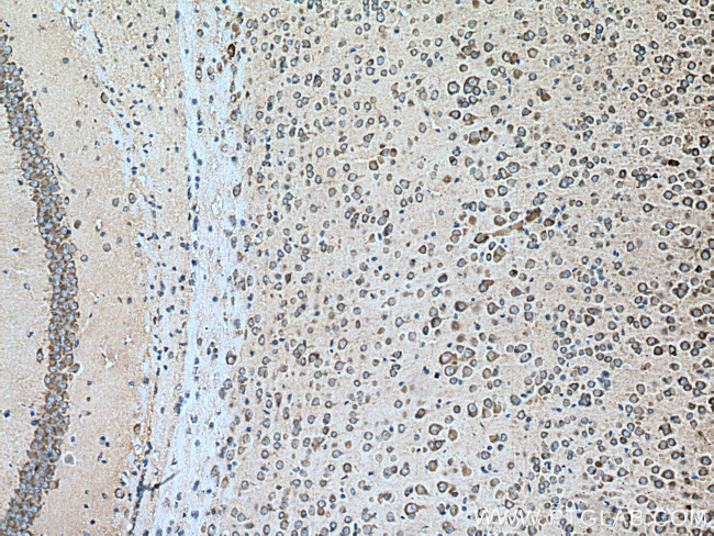 VPS26B Antibody in Immunohistochemistry (Paraffin) (IHC (P))