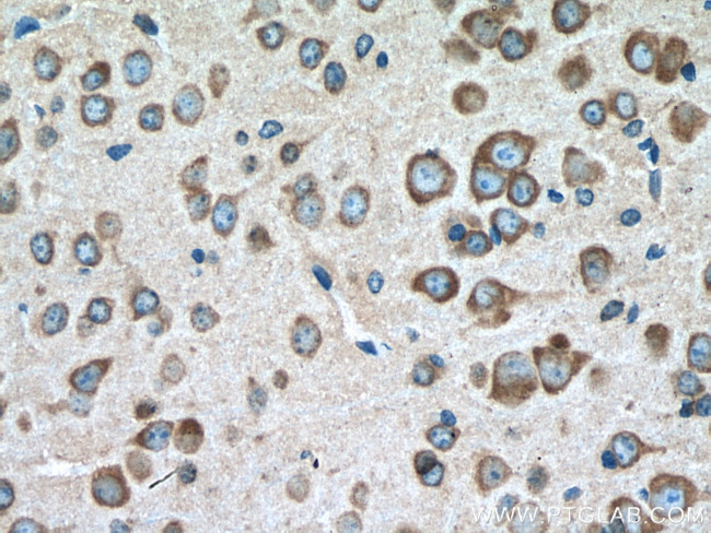 VPS26B Antibody in Immunohistochemistry (Paraffin) (IHC (P))