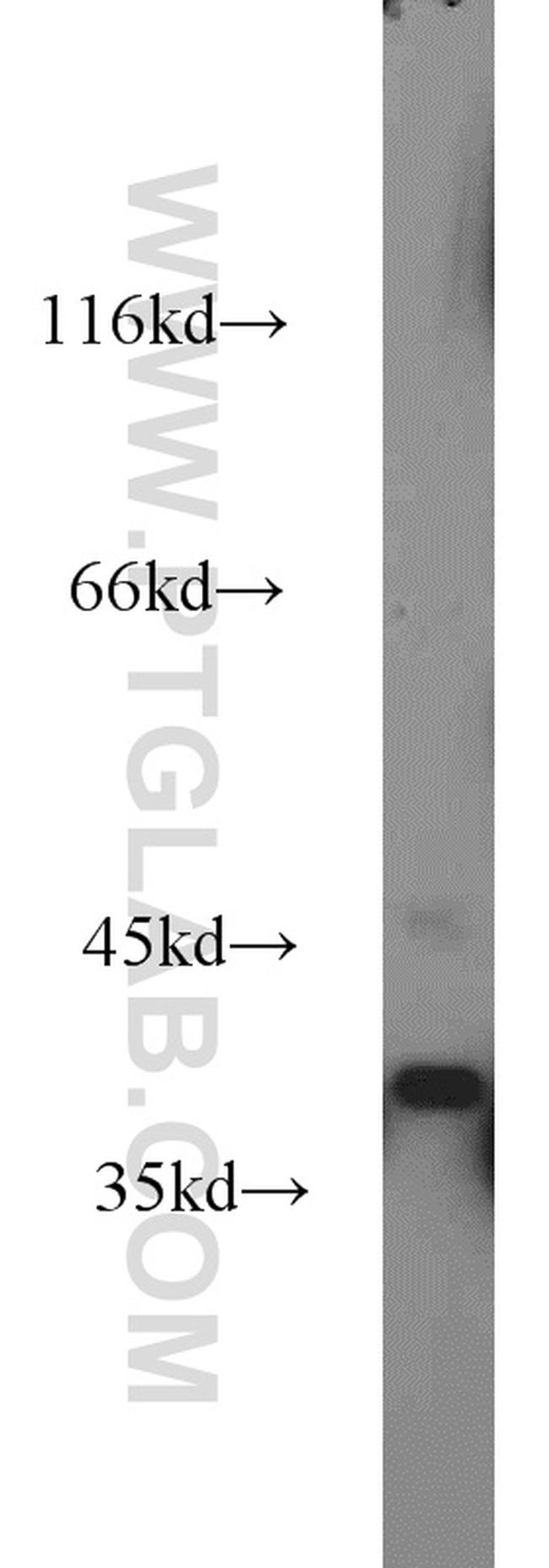 VPS26B Antibody in Western Blot (WB)