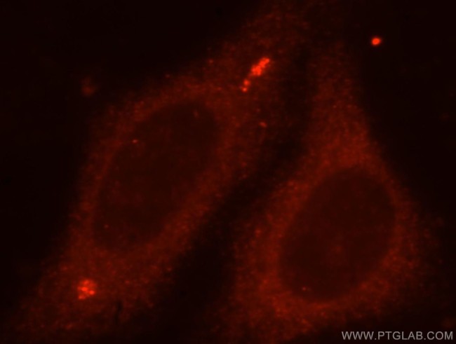 TBCC Antibody in Immunocytochemistry (ICC/IF)