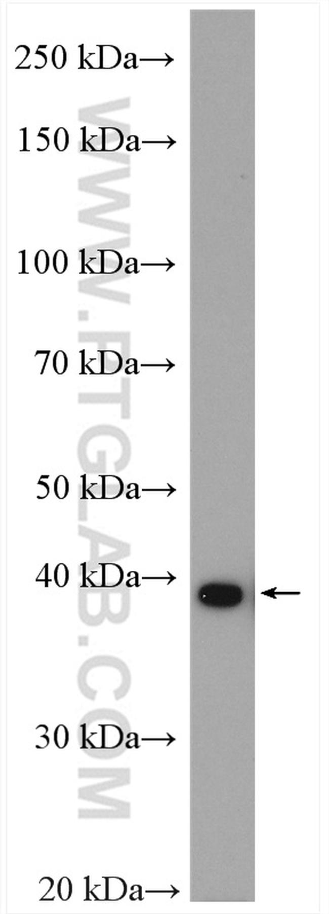 TBCC Antibody in Western Blot (WB)