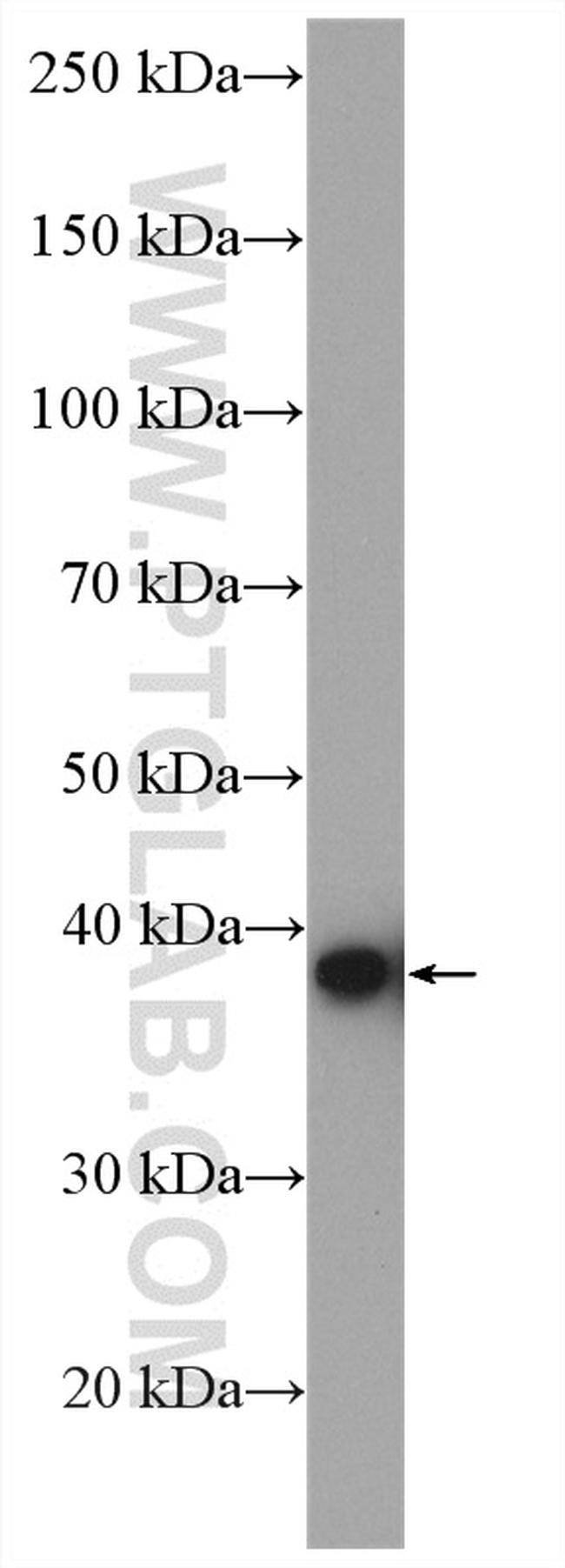 TBCC Antibody in Western Blot (WB)