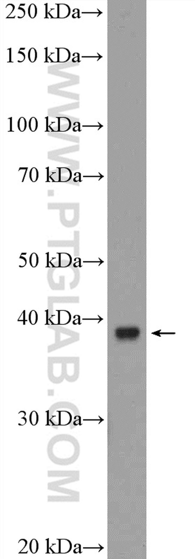 TBCC Antibody in Western Blot (WB)