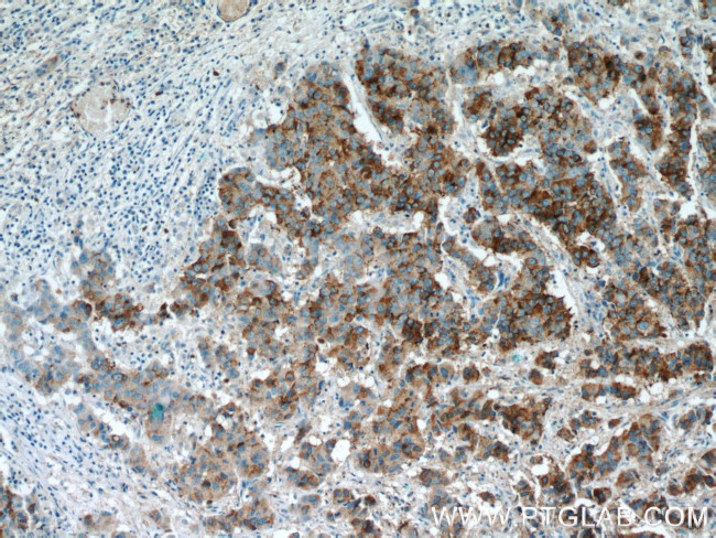 AMACR/p504S Antibody in Immunohistochemistry (Paraffin) (IHC (P))