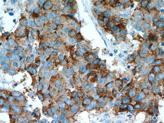 AMACR/p504S Antibody in Immunohistochemistry (Paraffin) (IHC (P))