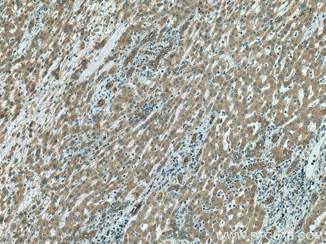 SLC12A4 Antibody in Immunohistochemistry (Paraffin) (IHC (P))