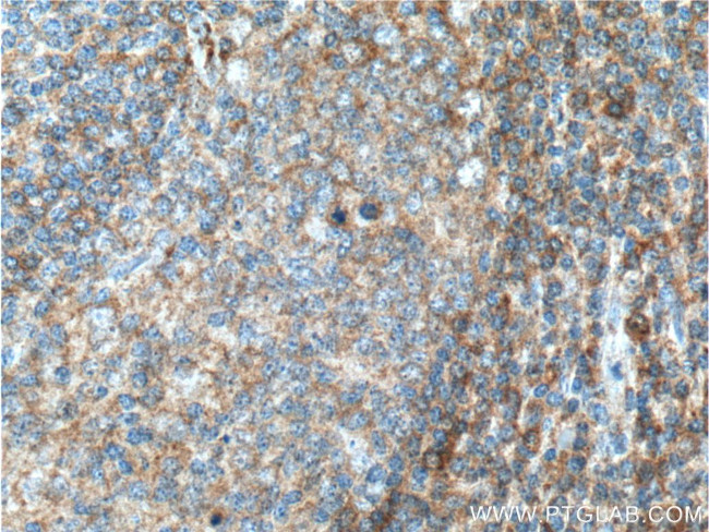 ValRS Antibody in Immunohistochemistry (Paraffin) (IHC (P))