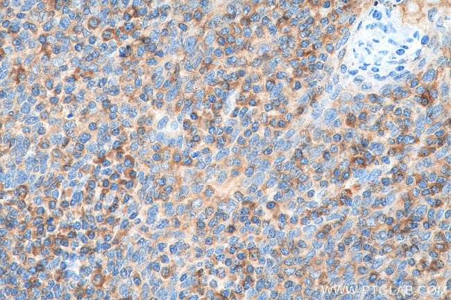 ValRS Antibody in Immunohistochemistry (Paraffin) (IHC (P))