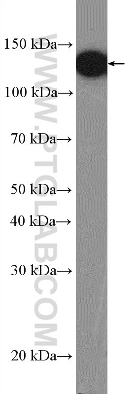 ValRS Antibody in Western Blot (WB)