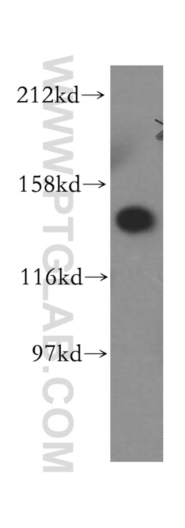 ValRS Antibody in Western Blot (WB)